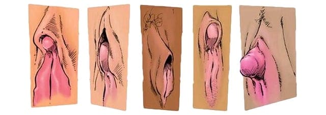 NXPL Taille Clitoris