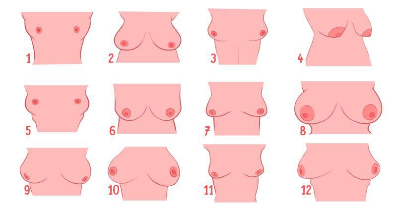Types de seins