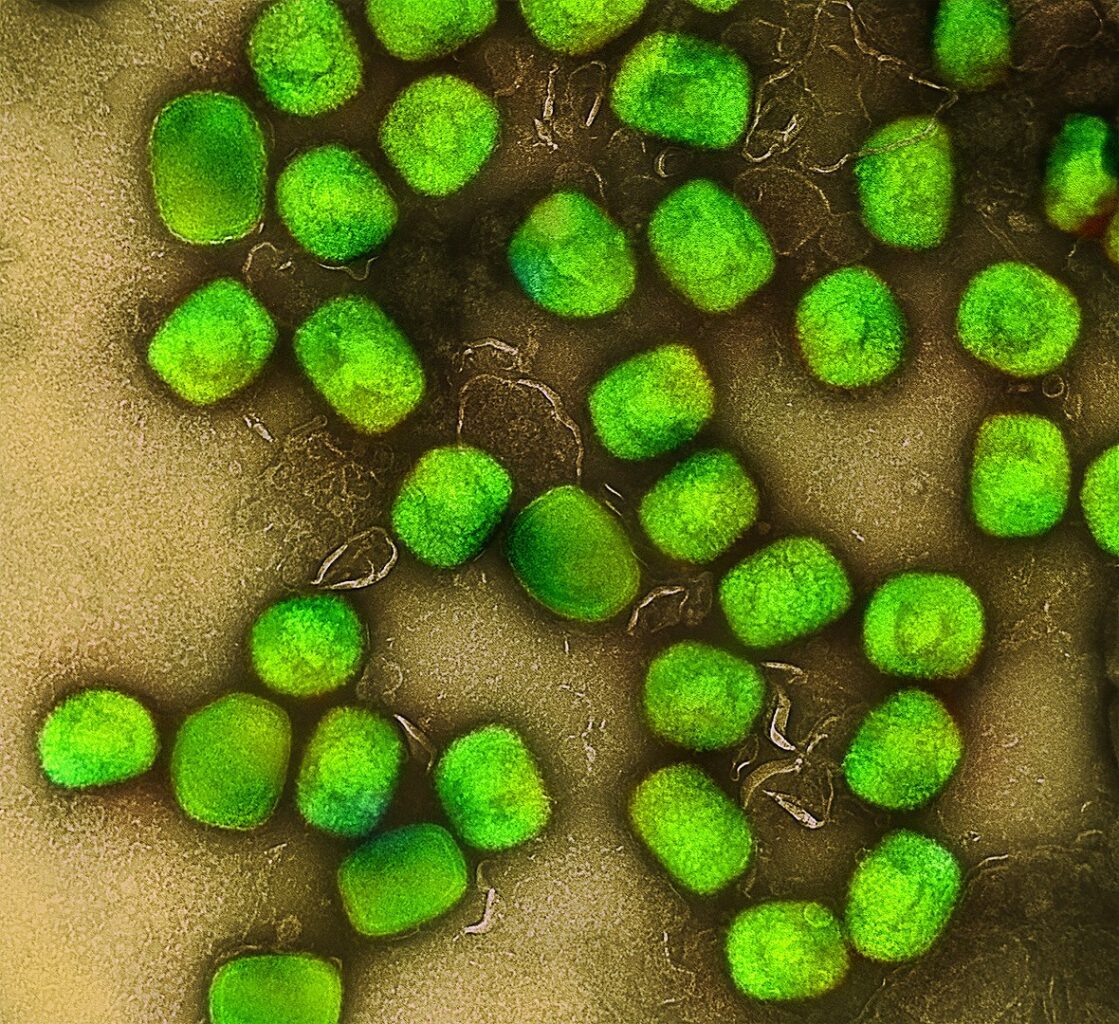 Virus de la variole du Singe - NXPL
